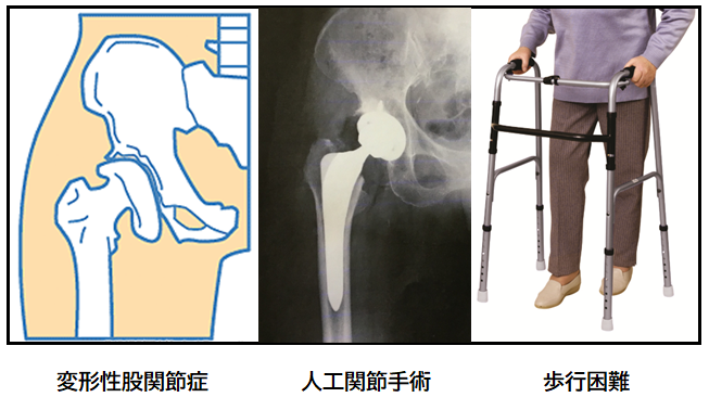 当院の施術法